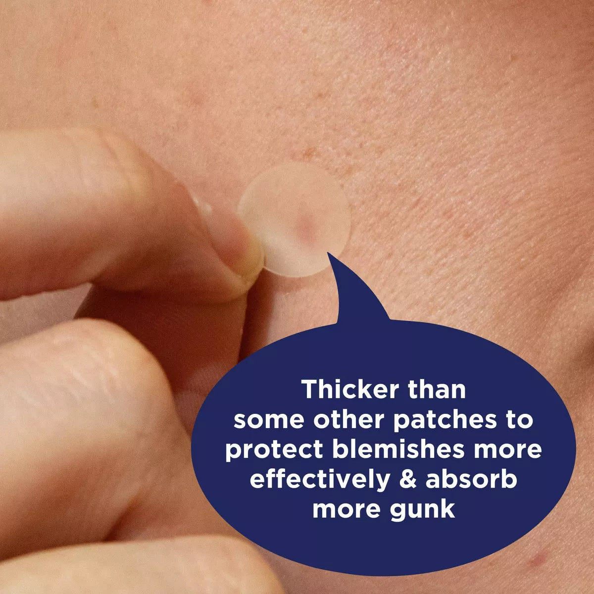 Panoxyl PM Overnight Spot Pimple Patches - 40Ct